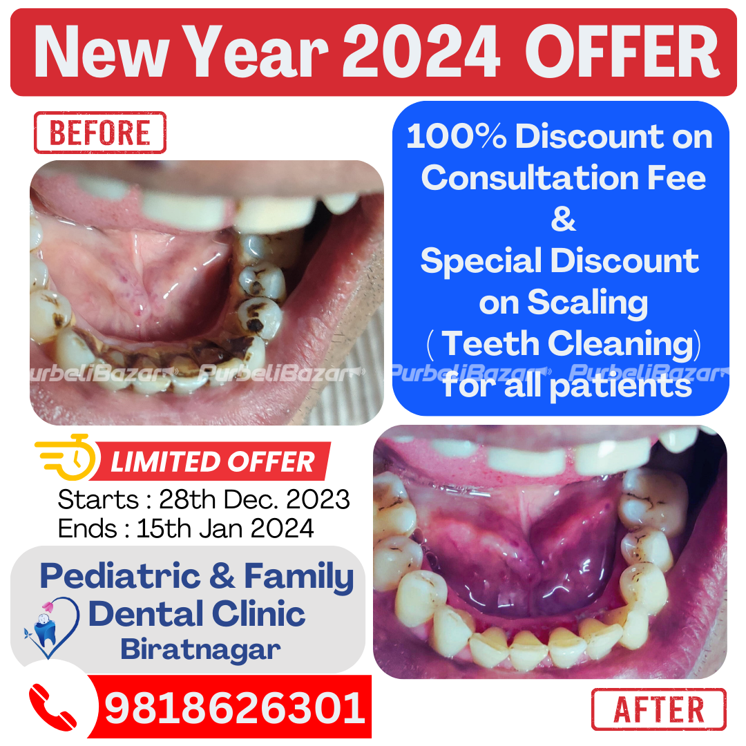 Best Tooth Scaling & Polishing Service at Biratnagar